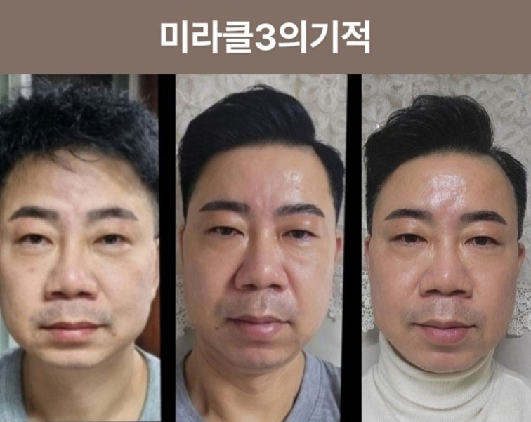 미라클3의 기적